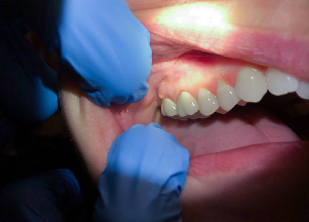 Best Emergency Dental Care for Trauma or Injury in Brookhaven, GA